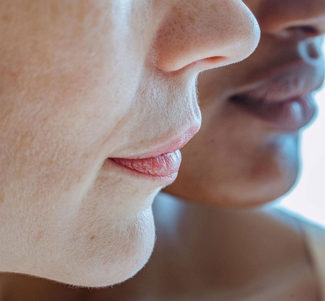 Lip+Filler+Superior,+CO,+Youthbar