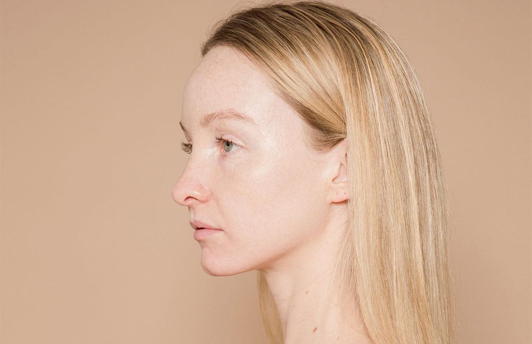 Sculptra+Superior,+CO,+Youthbar