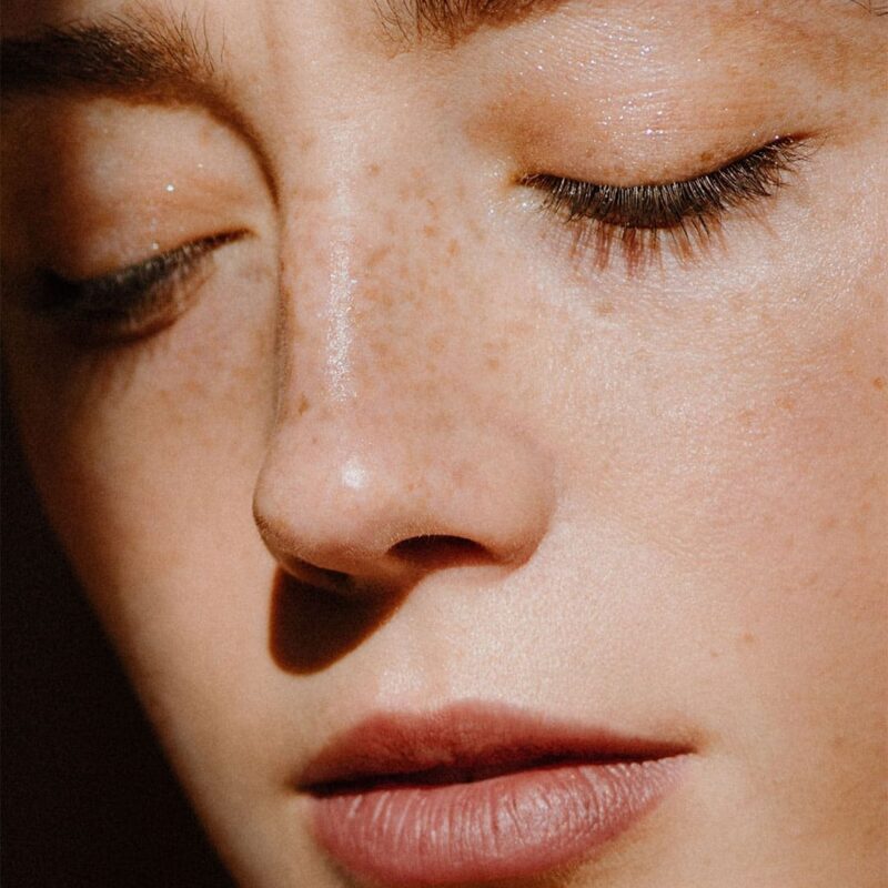 Botox For Girls