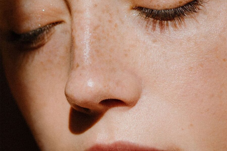 Botox For Girls